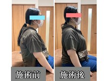 トモカ 吉川美南サロン(TOMOKA)/猫背、巻き肩、姿勢改善