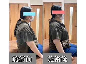 トモカ 吉川美南サロン(TOMOKA)/猫背、巻き肩、姿勢改善