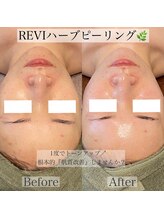 エステティックサロンR/シミ改善・しわ改善・たるみ改善