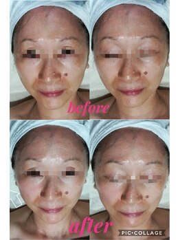 アマナプラーナ(Amana Praana)/GROTTY ビフォアアフター写真