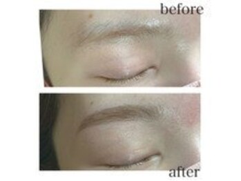 リルモナ(RIREMONA)/