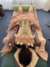 エル美容整体院/カッピングで血流改善！
