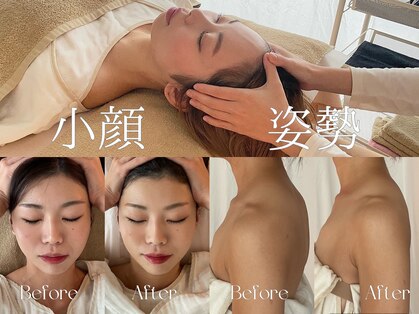 ティセ(TisseR)の写真