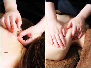 リマナ(Limana)の写真/《ガチガチ首肩コリにも深部までアプローチ》アロママッサージ/鍼灸でお身体の不調改善を叶えます！