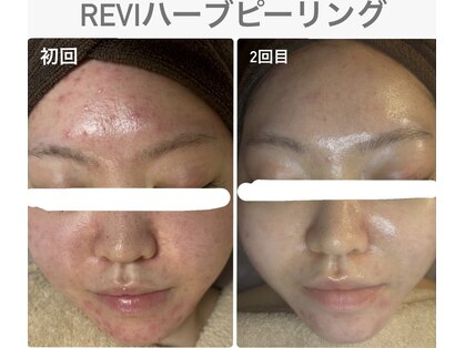 ココ(COCO)の写真