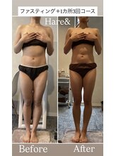 ハレアンド(Hare&)/1ヶ月集中コース