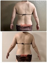 チュラ/ハイパーナイフ/所沢/痩身エステ