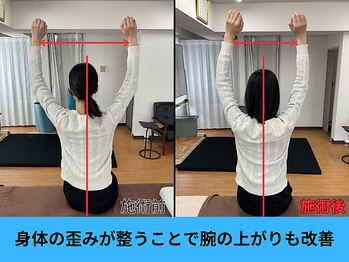 アオ整体院/20代女性ビフォーアフター☆