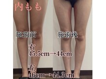 アモ(amo)の雰囲気（モニター価格掲載中です）