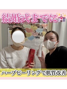 ホワイトアクア 梅田本店(WHITE AQUA)/ララピール/大阪/梅田/毛穴/小顔