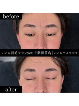 ユー 千葉駅前店(you)/ビフォ－アフター写真