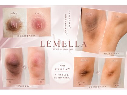 ピュアソル 福岡店(Puresol)の写真