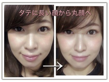 ラ アクサル(la.akthar)/小顔 小顔 小顔 小顔 小顔