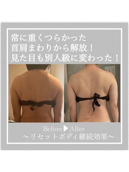 ミラトータルビューティ(Mira Total beauty)/姿勢が変わるとからだが変わる