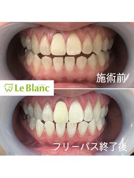 ルブラン 奈良店(Le Blanc)/頑張って良かった(^^)