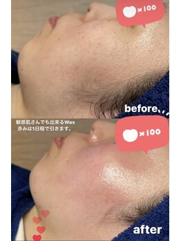 ロア(ROA)/フェイシャルワックス