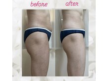 ヨサパーク エトワール 聖蹟桜ヶ丘店(YOSAPARK)/before、after♪