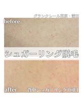 グランクレール トウキョウ(GRANDCLAIRE.TOKYO)/背中シュガーリング