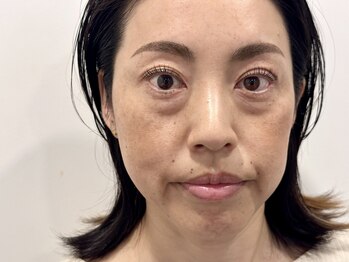 トミー(Tommy)/まつ毛パーマ