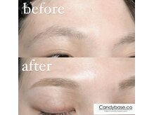 キャンディベース ノースアップ(Candybase North up)/垢抜けアイブロウ