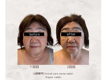 エスポワールカルド(Espoir caldo)/