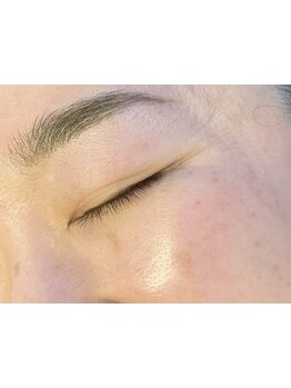 顔脱毛がしたい