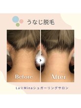 ラミーナ 新宿店(La☆Mina)/うなじ脱毛でスッキリな首元