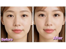 スタジオエムズ 稲毛海岸店(Studio M's)/before　after　イメージ