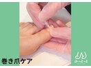 巻き爪ケア