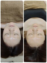 吉川美南ライフ整骨院/30代女性