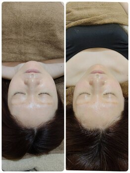 吉川美南ライフ整骨院/30代女性