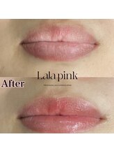 カルム(Calme)/Lalapink