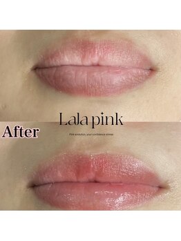 カルム(Calme)/Lalapink