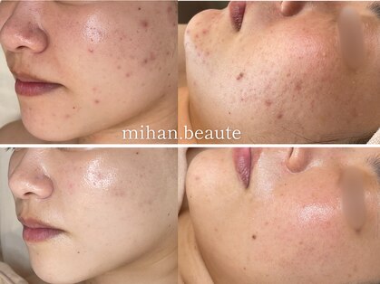 ミハン ボーテ(mihan.beaute)の写真
