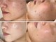 ミハン ボーテ(mihan.beaute)の写真