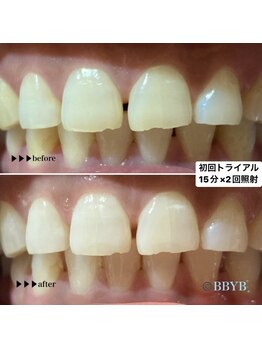 ビーバイビー(BBYB)/愛煙家&コーヒー好きな方★