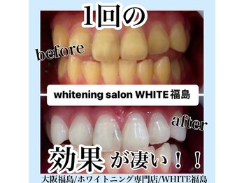 ホワイトニングサロン ホワイト(WHITE)/セルフホワイトニング/大阪/福島