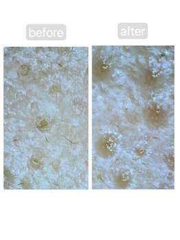 トランク(Trunk)/ハイドラ♪before→after