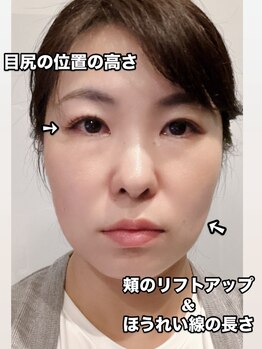 グリッタープラス(glitter plus)/耳つぼ+揉みほぐし