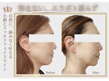 ベラ 東京院(Bella)の雰囲気（お客様の直美（チョクビ）増！エステでできること、あります♪）