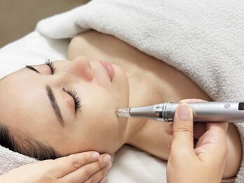 桜香(ほのか)の写真/【スッキリ小顔！】話題のレモンボトル脂肪分解で憧れのフェイスラインに◎（筋膜リリース×レモンボトル）