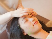 りんどう鍼灸整骨院の雰囲気（小顔矯正や美容鍼にララピールを組み合わせたメニューが人気です）