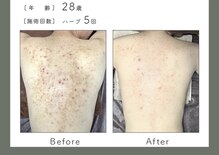 リラ 都城店(Lilas)