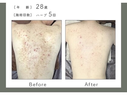 リラ 都城店(Lilas)の写真