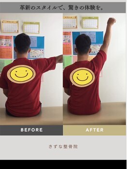 きずな整骨院 一宮院/肩の痛みがある方必見！