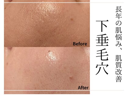 デコアイ(Deco eye)の写真