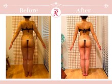 サロン アール(Salon R)/痩身施術×食事・インナーケア