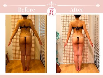 サロン アール(Salon R)/痩身施術×食事・インナーケア