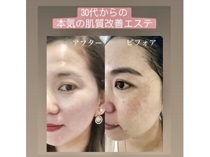 グラント(grant)の写真