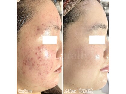 ナチュラリー 佐賀(Naturally)の写真